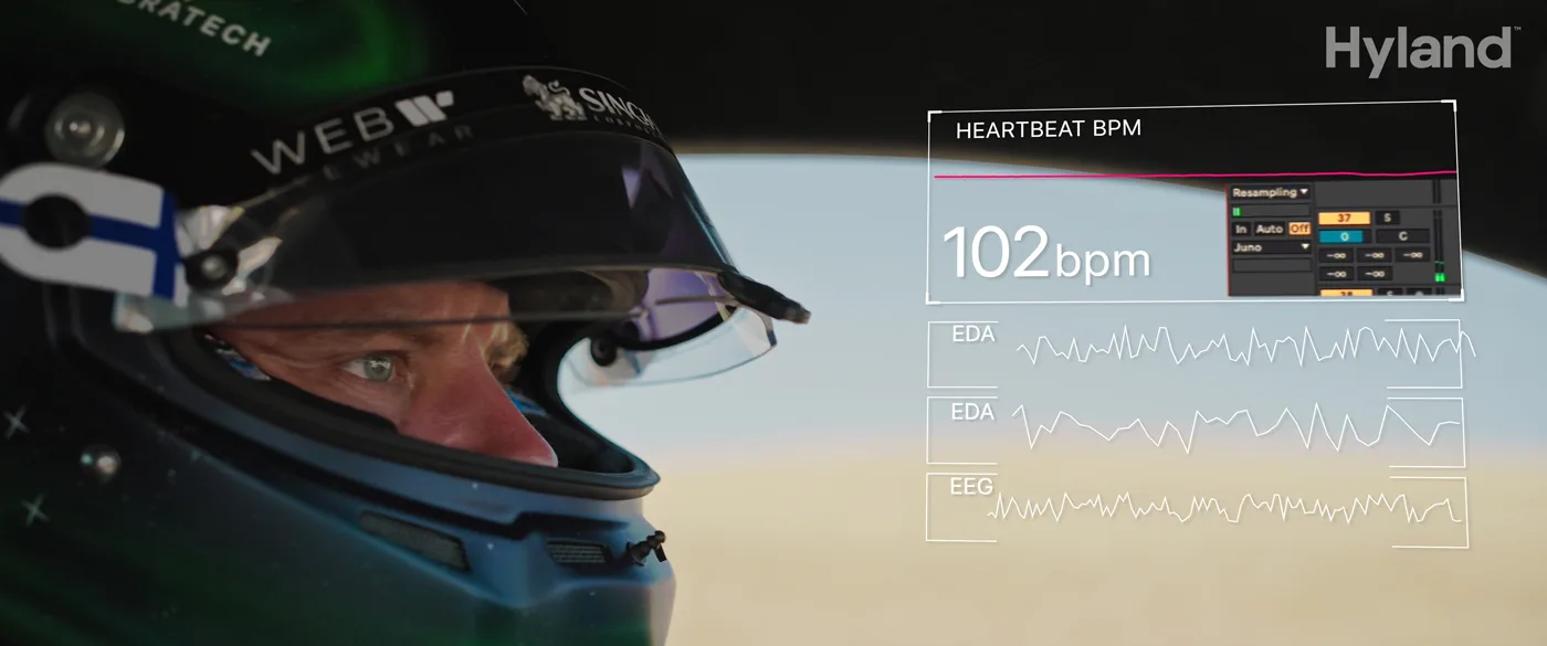 Monitoring F1 drivers heart rate to make music